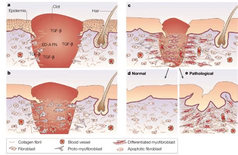 Model Of The Role Of Myofibroblasts During The Healing Of An Open