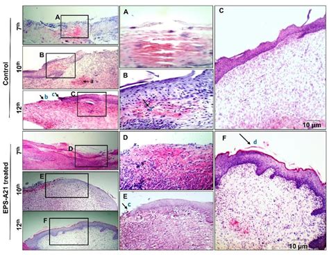 Histopathological Changes In Eps A Mediated Healing In Wistar Rats