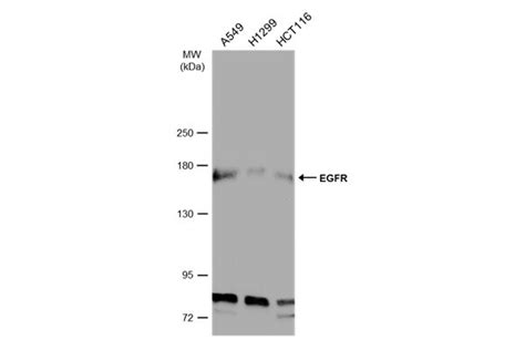 EGFR Antibody (PA5-85476)