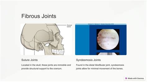 Classification Introduction To Joints Pptx