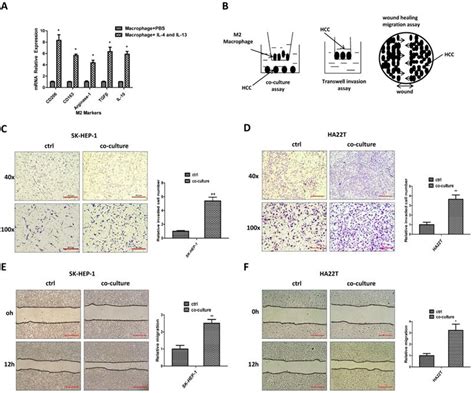 M2 Macrophages Promote Hcc Cells Invasion And Migration Via Mir 149 5p