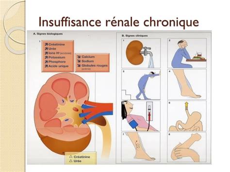 PPT Fonction et maladie du rein vers linsuffisance rénale PowerPoint