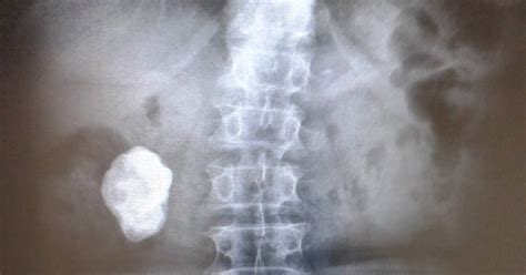 DICAS DE RADIOLOGIA Tudo Sobre Radiologia IMAGENS RADIOLÓGICAS