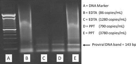 Coamplification Of Hiv 1 Proviral Dna And Viral Rna In Assays Used For