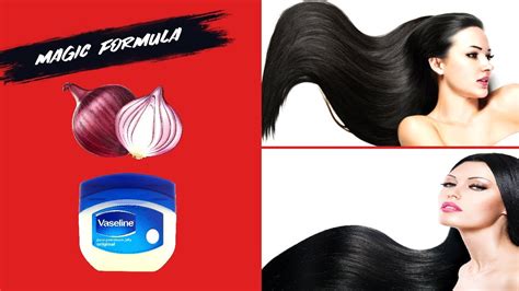 How To Use Vaseline And Onion To Grow Hair 2 Cm Per Day Very Fast 100