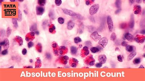 Absolute Eosinophil Count (AEC): Purpose & Normal Range of Results | 1mg