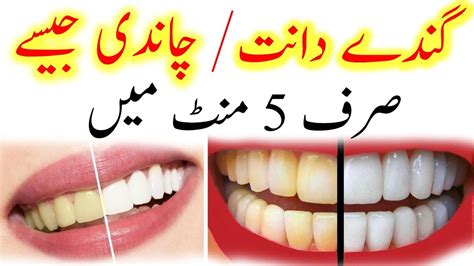 Teeth Saaf Karne Ka Tarika Daant Saaf Karny Ka Totka In Mints Youtube