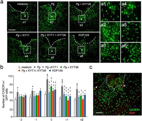 Infection Of The CX3CR1 GFP Mouse Brain With P Gingivalis Promotes