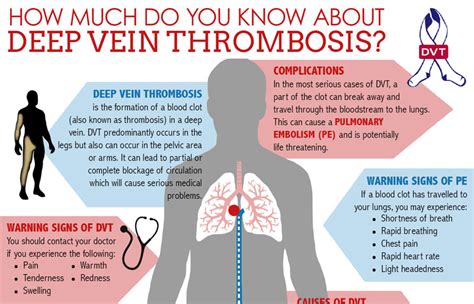 Deep Vein Thrombosis Infographic Michigan Vein Care Specialists