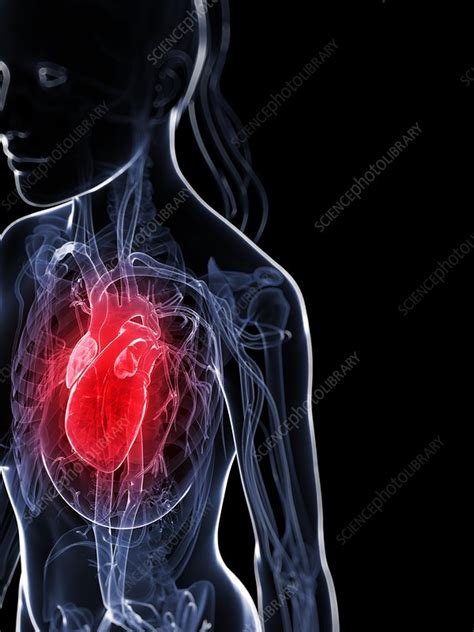 Female Vascular System Artwork Stock Image F009 5847 Science