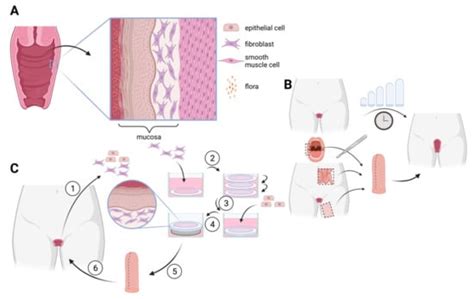 Ijms Free Full Text Tissue Engineering In Gynecology