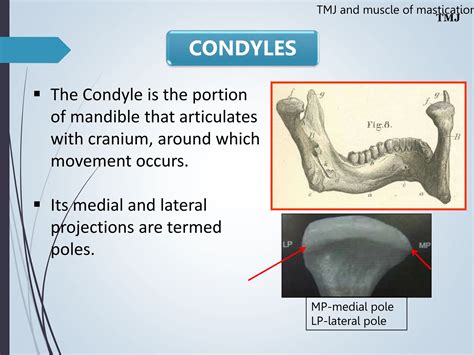 Temporomandibular Joint Muscles Of Mastication PPT