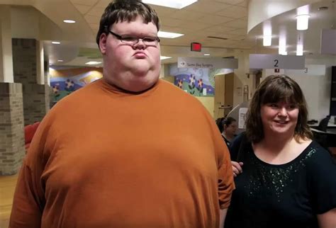 Con 325 Kilos Era El Adolescente Más Gordo Del Mundo