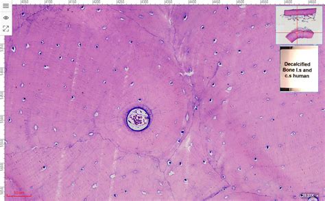 Decalcified Compact Bone L S C S Show Osteon And Haversian System