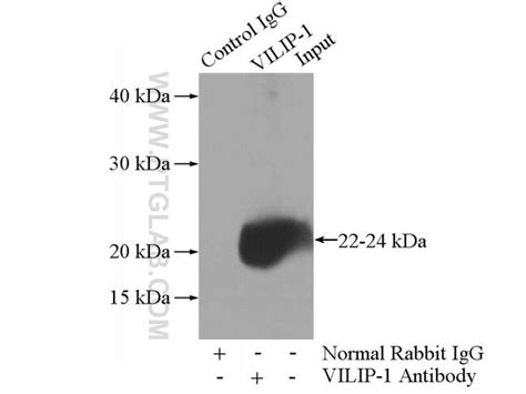 VILIP 1 Rabbit anti Human Mouse Rat Polyclonal Proteintech 20 μL