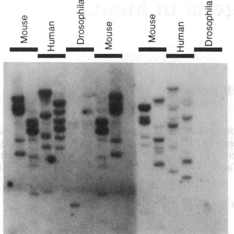 Genomic Southern Blot Analysis Of Msos 1 And Msos 2 Genes Human