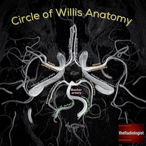 Need A Refresher On Circle Of Willis Anatomy Check Out This Image