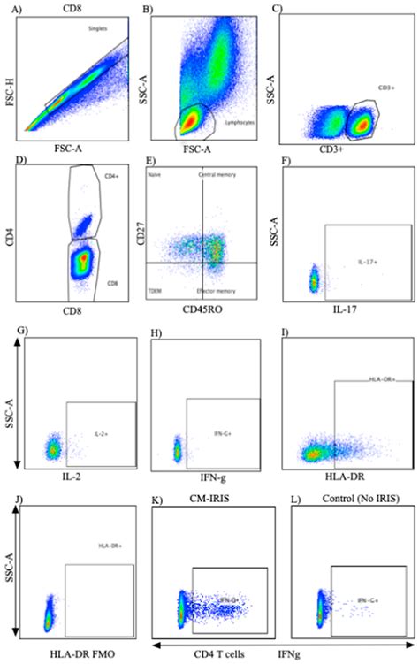 Jof Free Full Text Hiv Associated Cryptococcal Immune Reconstitution Inflammatory Syndrome