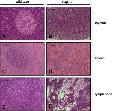 Histological Evaluation Of Lymphatic Organs Of Wild Type And Rag1