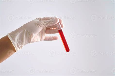 Prueba Tubo Con Sangre En El Mano Foto De Stock En Vecteezy