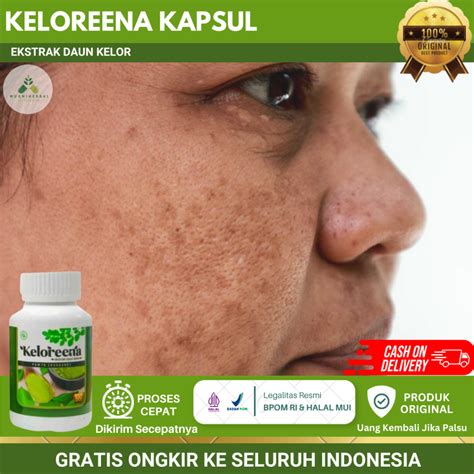 Jual Keloreena Kapsul Original Obat Untuk Flek Hitam Noda Hitam