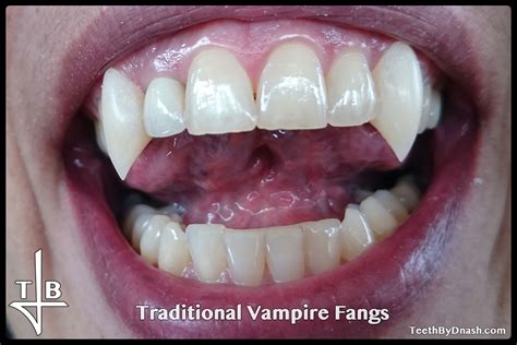 Traditional Vampire Teeth By Dnash