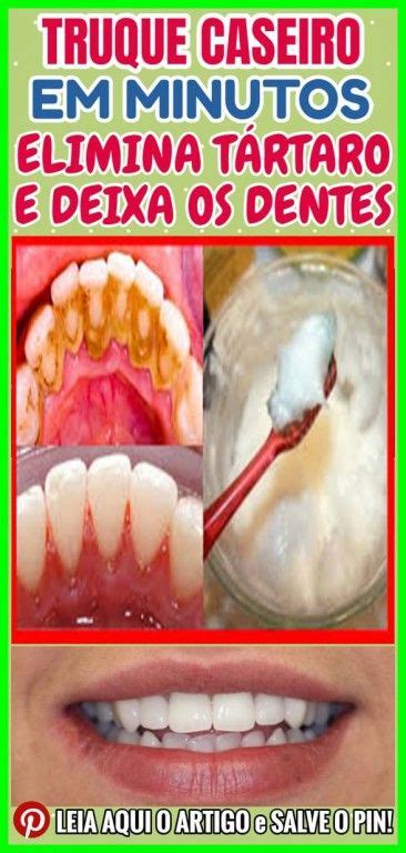 Receita Caseira Para Remover A Placa Bacteriana E O T Rtaro Dos Dentes