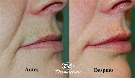 Dermatología cosmética Dermaclinic