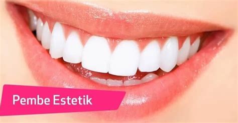 Pembe Estetik Nedir Nasıl Yapılır Akvadent