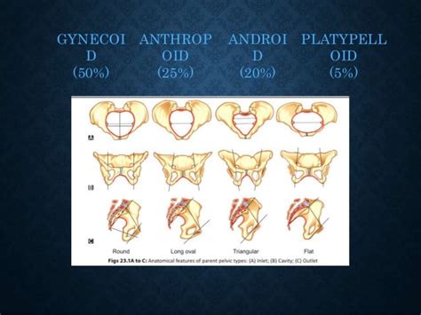 Classification Of Pelvis