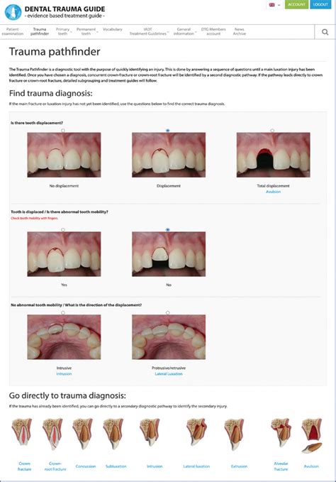 The Dental Trauma Guide: An evidence-based treatment guide : Endodontology