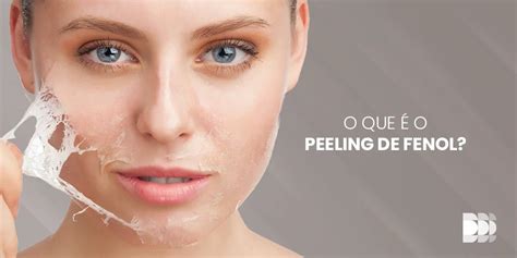 O Que O Peeling De Fenol N Cleo Dome