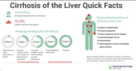 Cirrhosis Of The Liver Gastroenterology Advisor