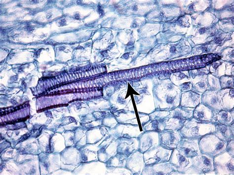 Cell Types Xylem