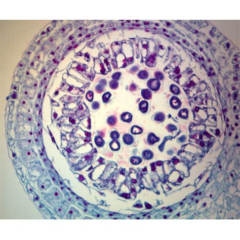 Prophase 1 Of Meiosis Under A Microscope