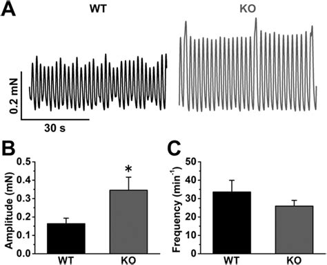 Increased TMEM16A Mediated Ca 2 Activated Cl Currents In Portal