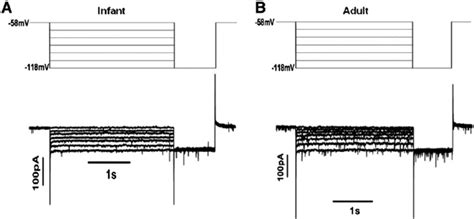 Evidence for the absence of hyperpolarization-activated current (I H ...