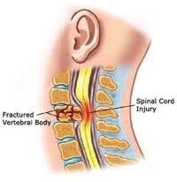 Brain Spine Trauma Surgeon In Pune Dr Prashant Khandelwal