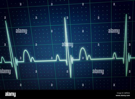 Flatline death hi-res stock photography and images - Alamy