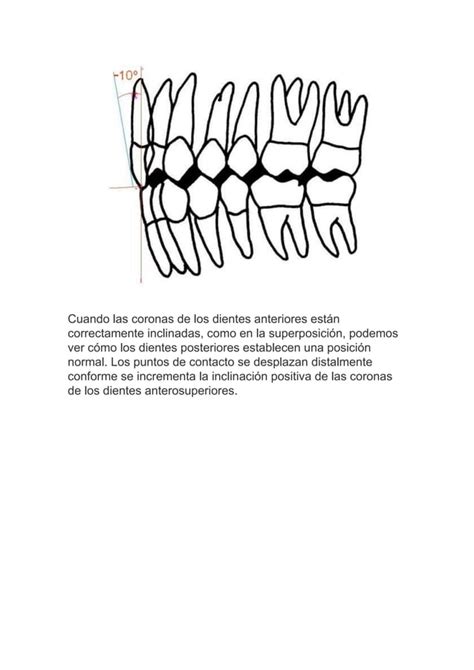 Las Seis Claves De La Oclusión Normal En Ortodoncia Pdf