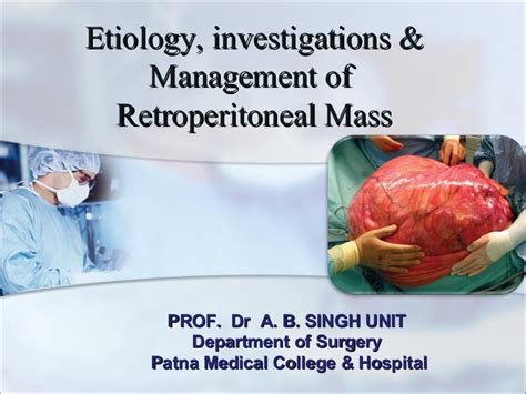 Retroperitoneal Mass