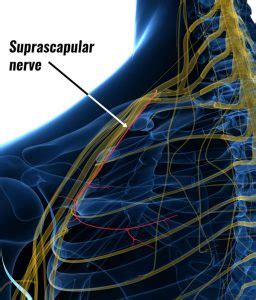 Suprascapular Neuropathy Symptoms Causes And Treatment