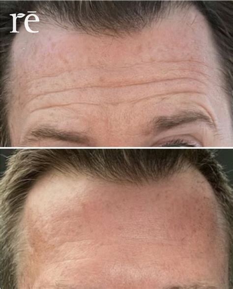 Mens Injectables Rē Salon and Med Spa