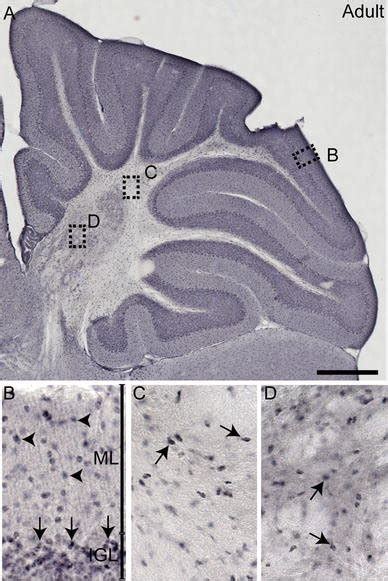 Robust Expression Of NFIX By Granule Neurons Of The Mature Cerebellum