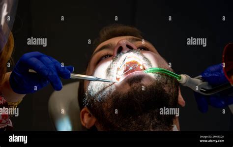 Tooth Decay Prevention Man In The Dentist Chair During A Dental