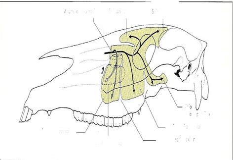 Seios Da Face Anatomia Topogr Fica