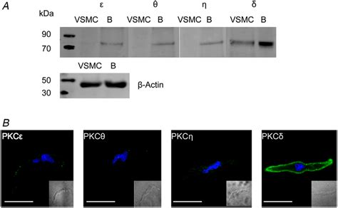 Expression Of Novel PKC Isoforms In Native Contractile VSMCs A