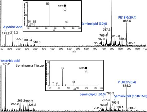 Representative Negative Ion Mode Full Scan Mass Spectra Of Seminoma And