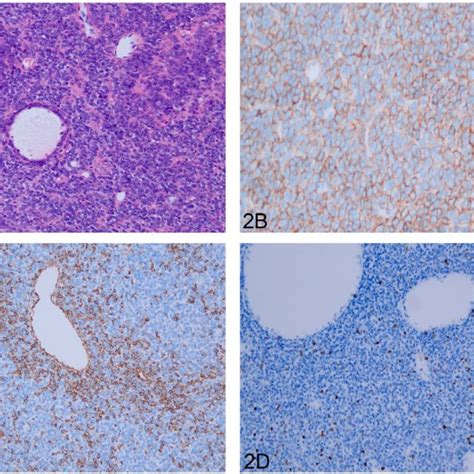 Immunohistochemistry Ihc Upper Panel Showing A Hematoxylin And