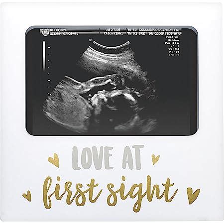 Amazon Sonogram Picture Frame Keepsake Baby Ultrasound Framelove